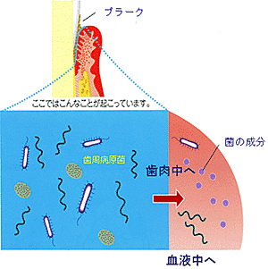 山口県柳井市の歯医者の歯医者、いそべ歯科医院