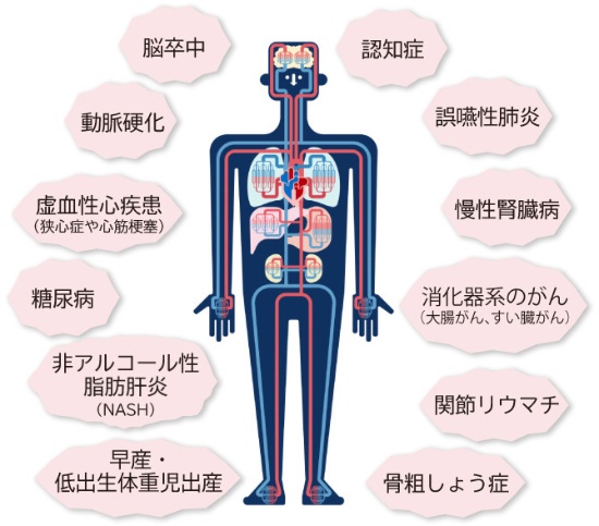 山口県柳井市の歯医者の歯医者、いそべ歯科医院で、歯周病治療